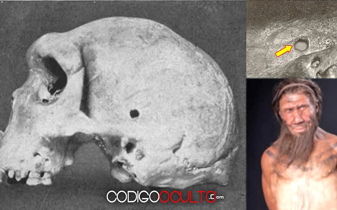 Enigmas de la Prehistoria: Cráneo con «agujero de bala» (125.000 A.C.)