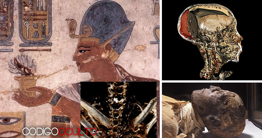 «Faraón Ramsés III fue asesinado por múltiples atacantes», afirma radiólogo