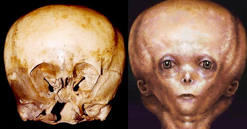 El misterio detrás del cráneo del Starchild: ¿Los restos de un antiguo extraterrestre?