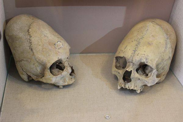 Cráneo deformado en el Museo Arqueológico de Kerch