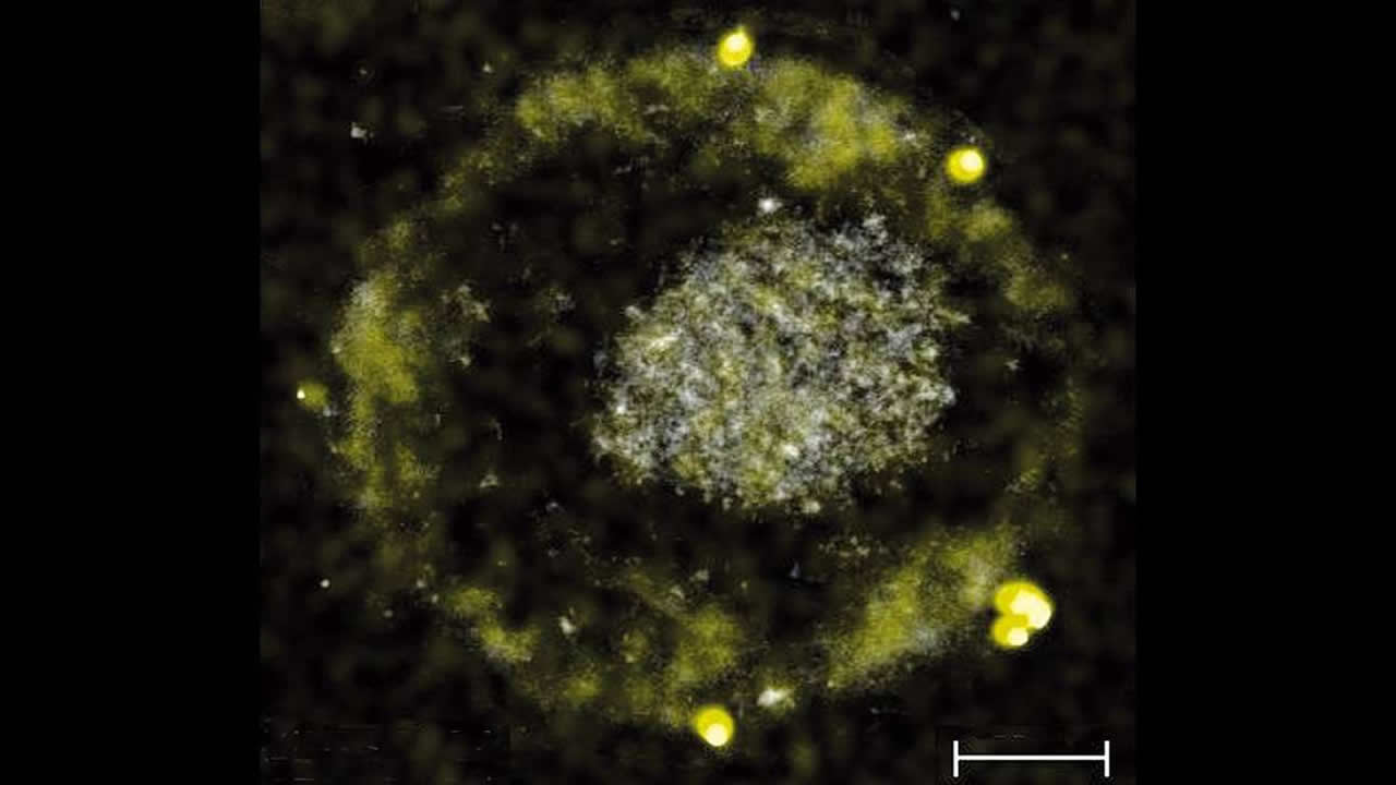Esta bacteria come metales tóxicos y produce pepitas de oro