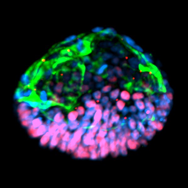 Un «embrioide» creado a partir de células madre comparte características clave con un embrión humano real, como un saco amniótico, pero carece de otros elementos
