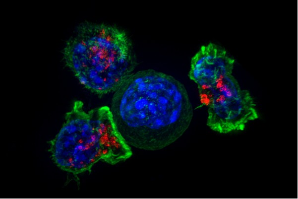 Las células T rodean una célula cancerosa