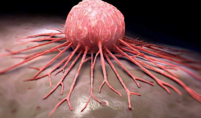 Revelan un nuevo mecanismo para «activar» el sistema inmunológico contra el cáncer Revelan un nuevo mecanismo para «activar» el sistema inmunológico contra el cáncer