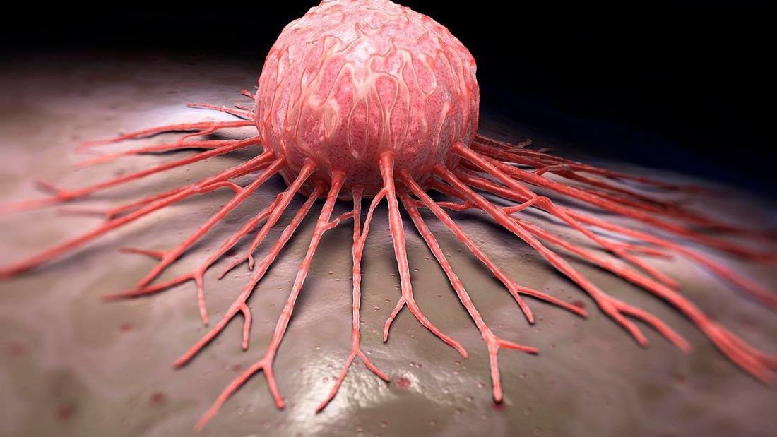 Revelan un nuevo mecanismo para «activar» el sistema inmunológico contra el cáncer