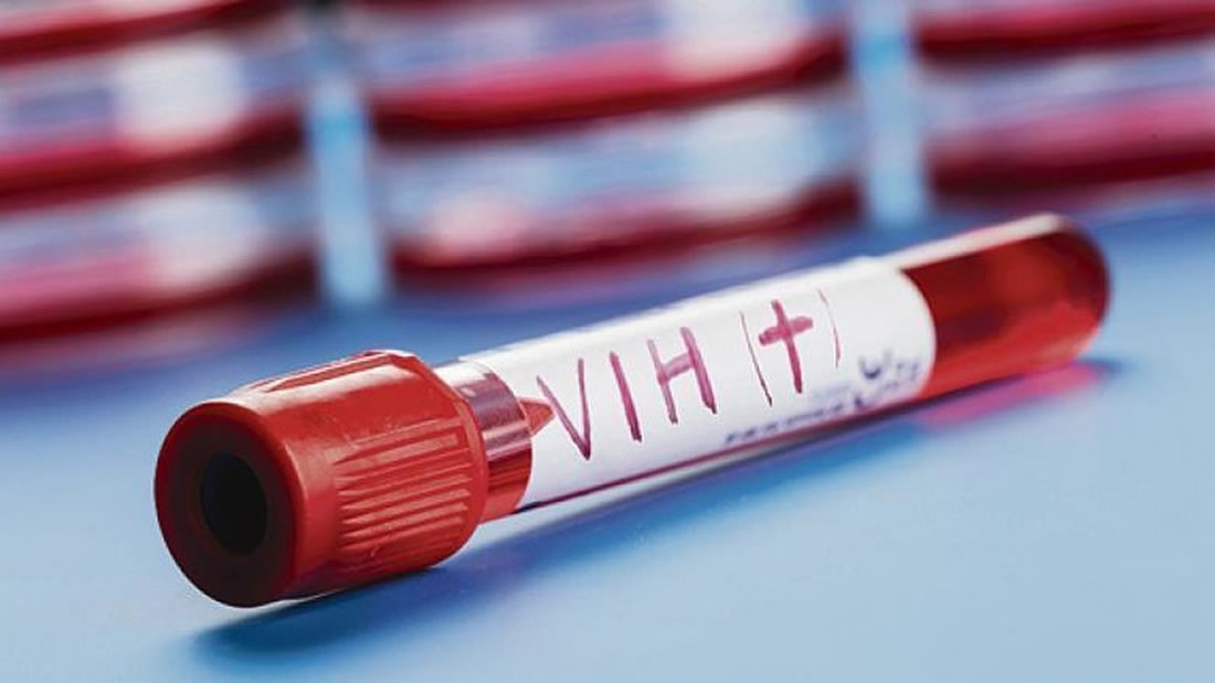 Eliminan el VIH de un paciente por segunda vez en la historia