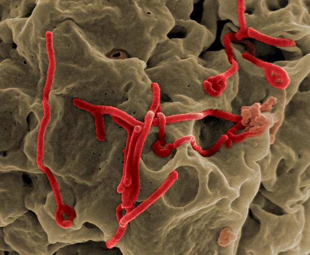 Micrografía electrónica de barrido del virus del Ébola que brota de la superficie de una célula