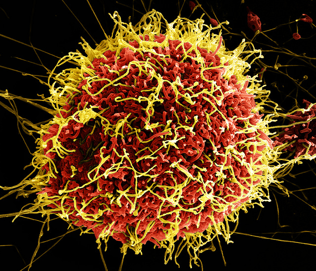 Micrografía electrónica de barrido coloreada de partículas de virus de Ébola filamentosas (amarillas) unidas y brotando de una célula infectada crónicamente