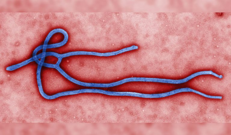 Podrían haber hallado la cura del Ébola utilizando anticuerpos humanos Podrían haber hallado la cura del Ébola utilizando anticuerpos humanos