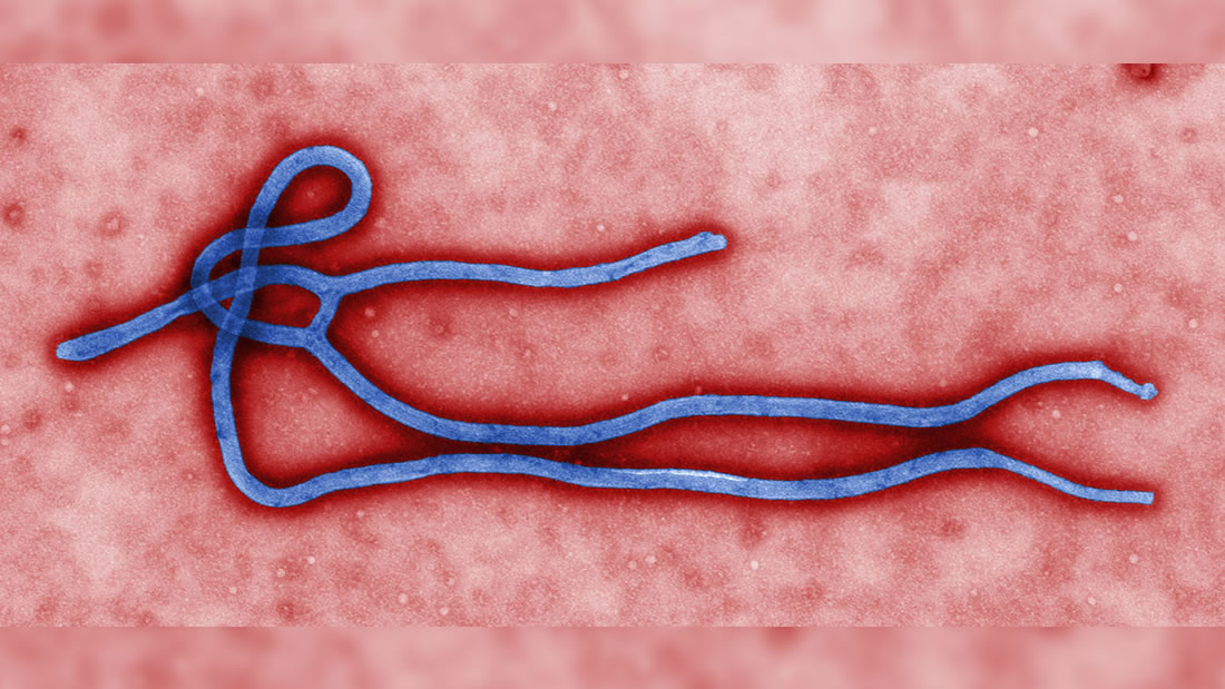 Podrían haber hallado la cura del Ébola utilizando anticuerpos humanos