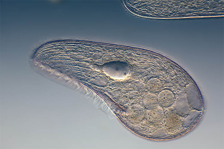 Imagen de un protozoo. Los que han observado larvas astrales (en viajes astrales) los han descrito con una forma similar