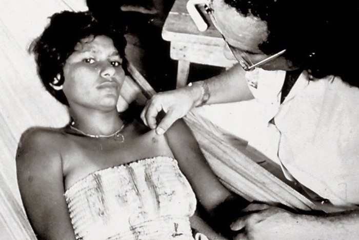 Ilustración 6 Una de las víctimas de Chupa-Chupa, Aurora Fernandes, siendo examinada por el Dr. Orlando Soghbi