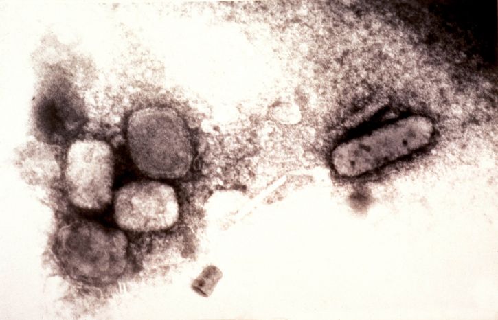 Micrografía del virus de la viruela