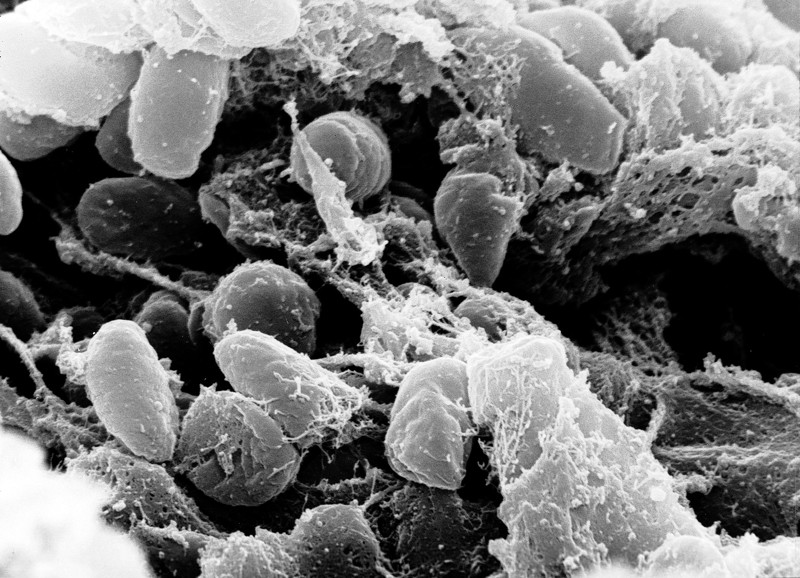 Microfotografía con microscopio electrónico mostrando bacterias Yersinia Pestis
