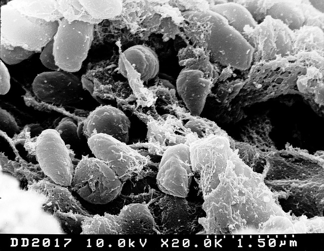 Una micrografía electrónica de barrido que representa una masa de bacterias Yersinia pestis en el intestino de una pulga infectada