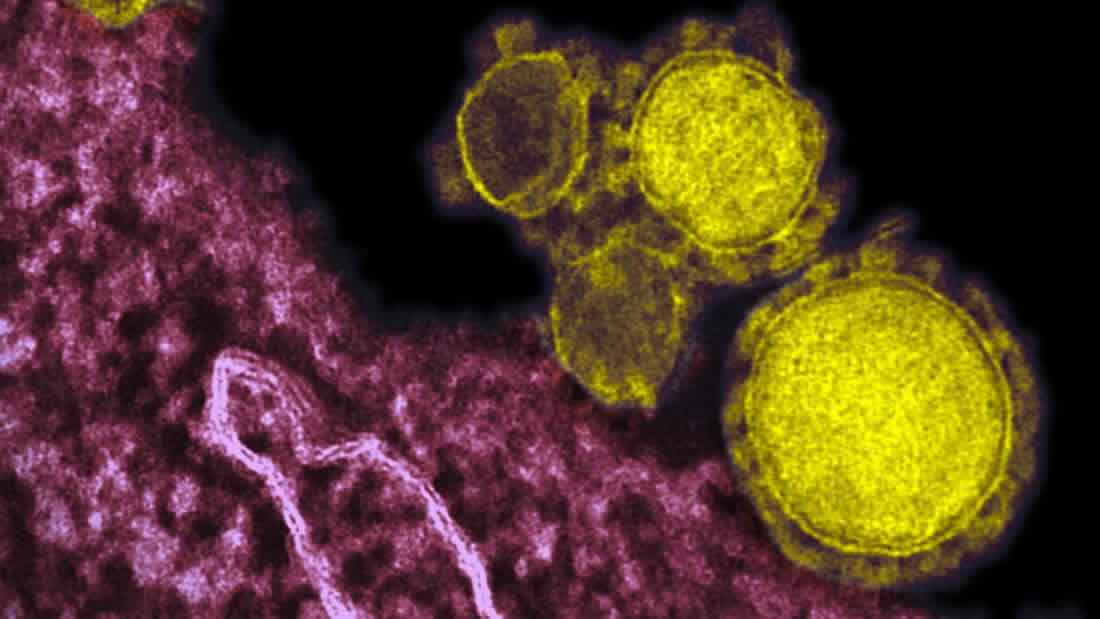 Confirman dos casos de coronavirus en México: Ciudad de México y Sinaloa