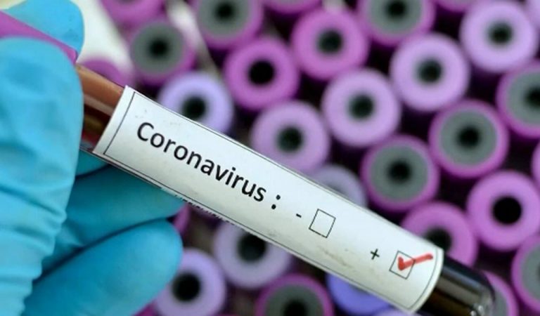 Mapean proteína clave del coronavirus para crear una vacuna Mapean proteína clave del coronavirus para crear una vacuna