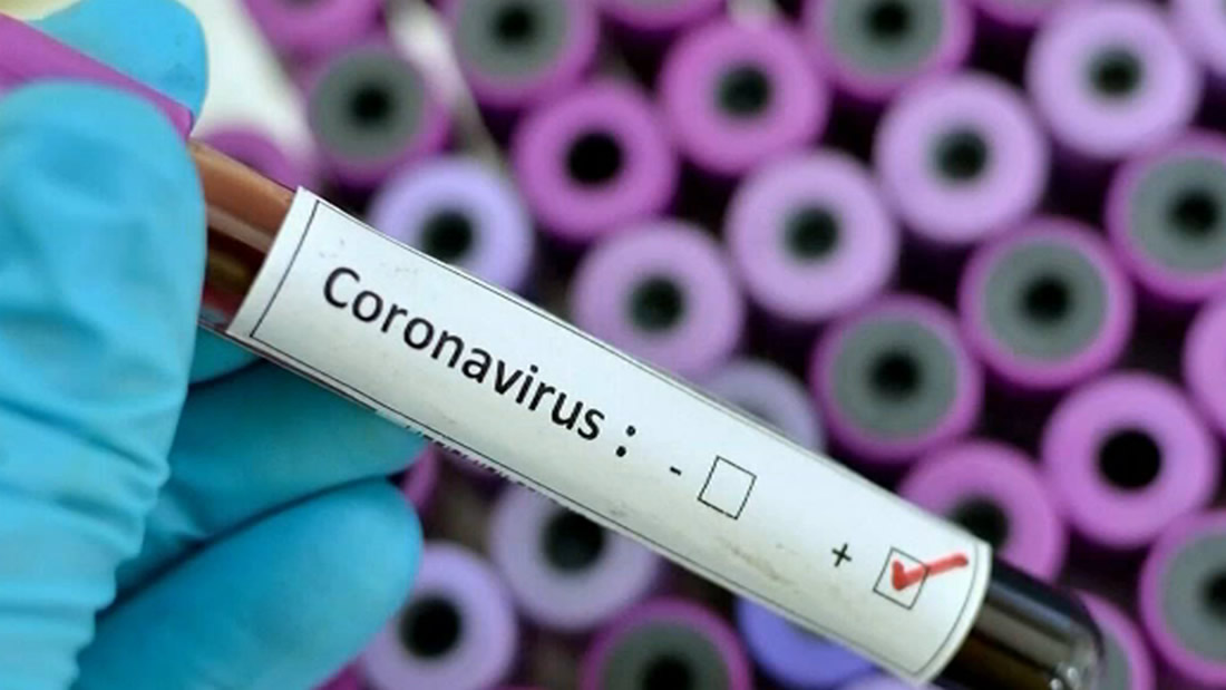 Mapean proteína clave del coronavirus para crear una vacuna
