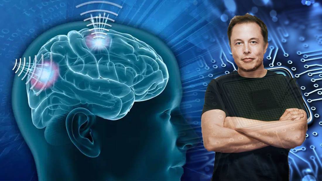 Elon Musk anuncia que su empresa Neuralink comenzará a fabricar implantes para cerebros humanos «en menos de un año»
