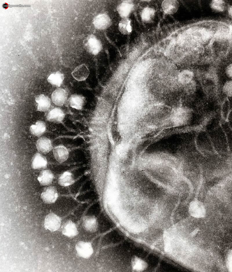 Bacteriófagos infectando a una bacteria a través de un microscopio electrónico