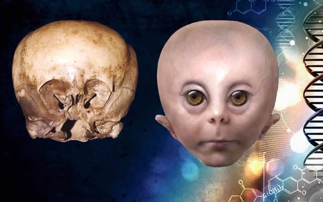 La misteriosa historia tras el Cráneo de StarChild o “Niño de las Estrellas”