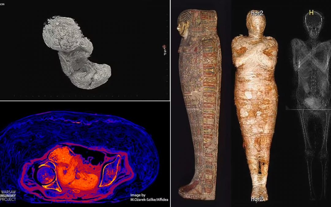 Cómo un feto de 28 semanas se preservó dentro de una momia egipcia durante 2.000 años