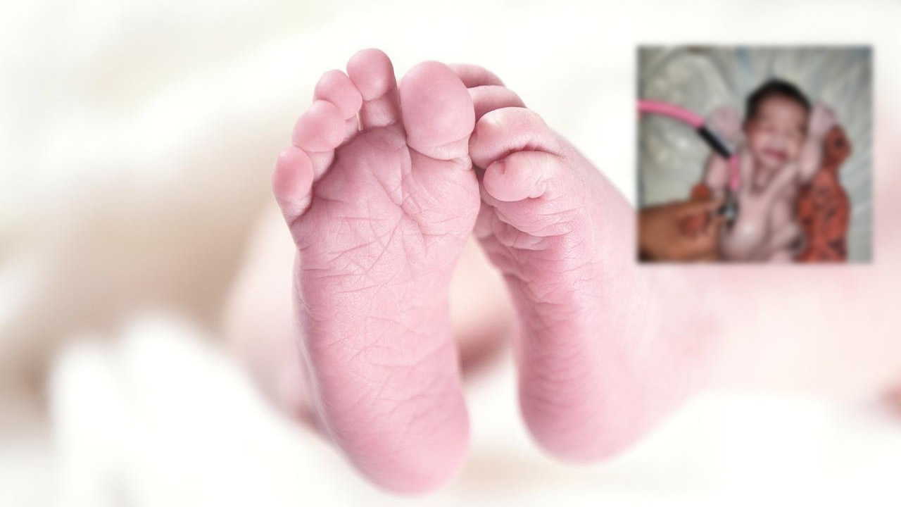 India Nace Bebé Con Cuatro Brazos Y Cuatro Piernas Es Considerado “reencarnación De Dios 4808