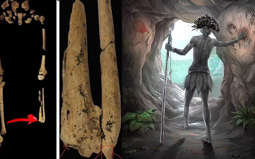 Descubren la evidencia de amputación quirúrgica más antigua del mundo: ¡31.000 años!