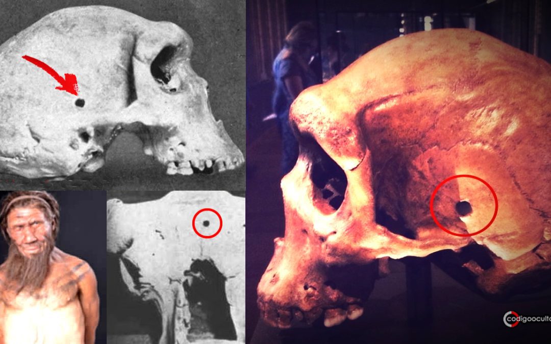 El misterio de los cráneos prehistóricos con posible “agujero de bala”