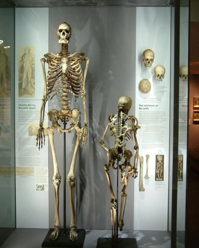El esqueleto de charles byrne en exhibición