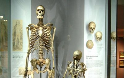 Esqueleto del “gigante irlandés” será retirado de museo luego de 200 años