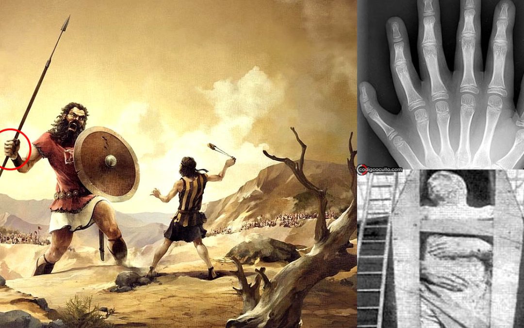 Humanos de seis dedos: ¿Indicadores de una civilización perdida?