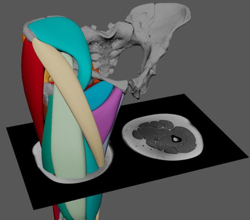 Wiseman usó escaneos de humanos modernos como referencia a los músculos en capas en un modelo virtual del esqueleto de lucy.