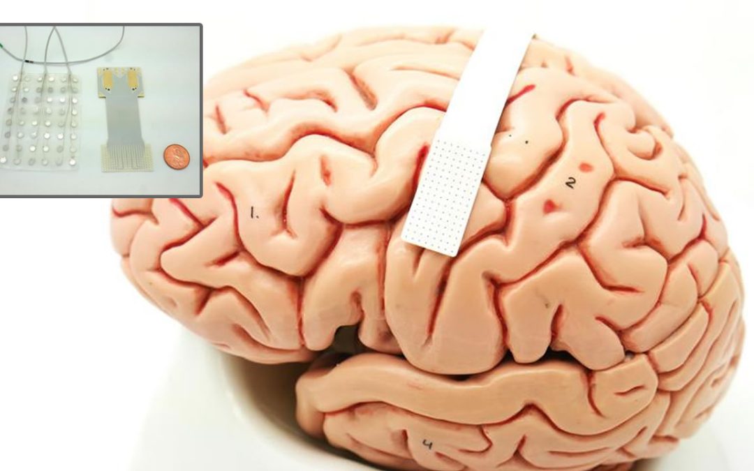 Logran traducir los pensamientos en palabras con un implante cerebral con alta eficiencia