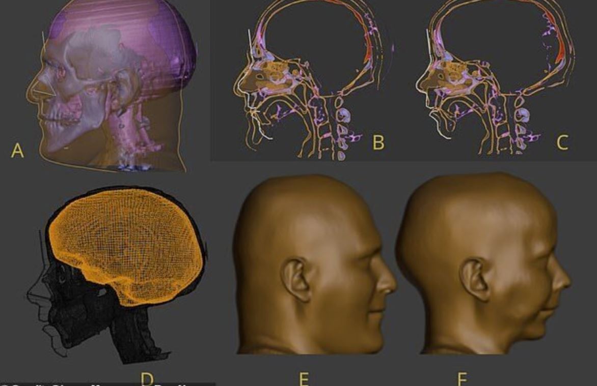 La imagen de Minirdis se reconstruyó utilizando un modelo digitalizado de su cráneo, al que se añadió tejido blando, y el proceso fue guiado por datos de personas vivas, incluido el grupo de edad correspondiente.