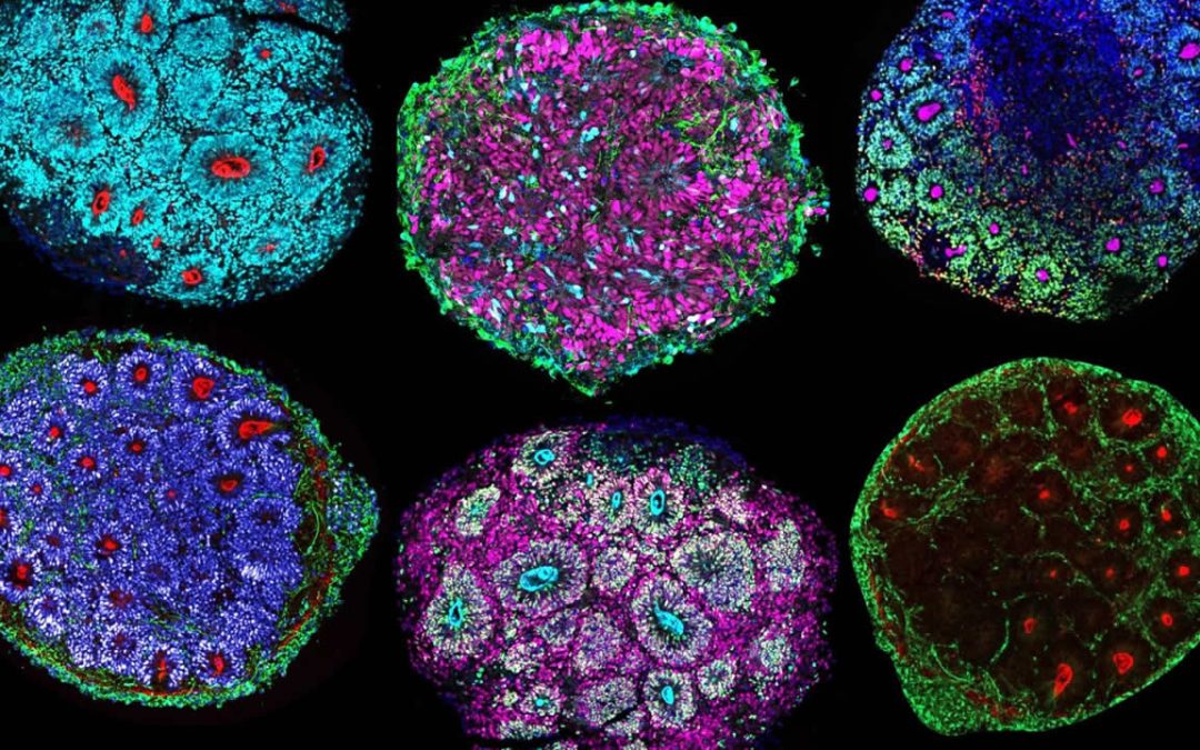 Científicos cultivan en laboratorio el primer “minicerebro” a partir de células de varias personas