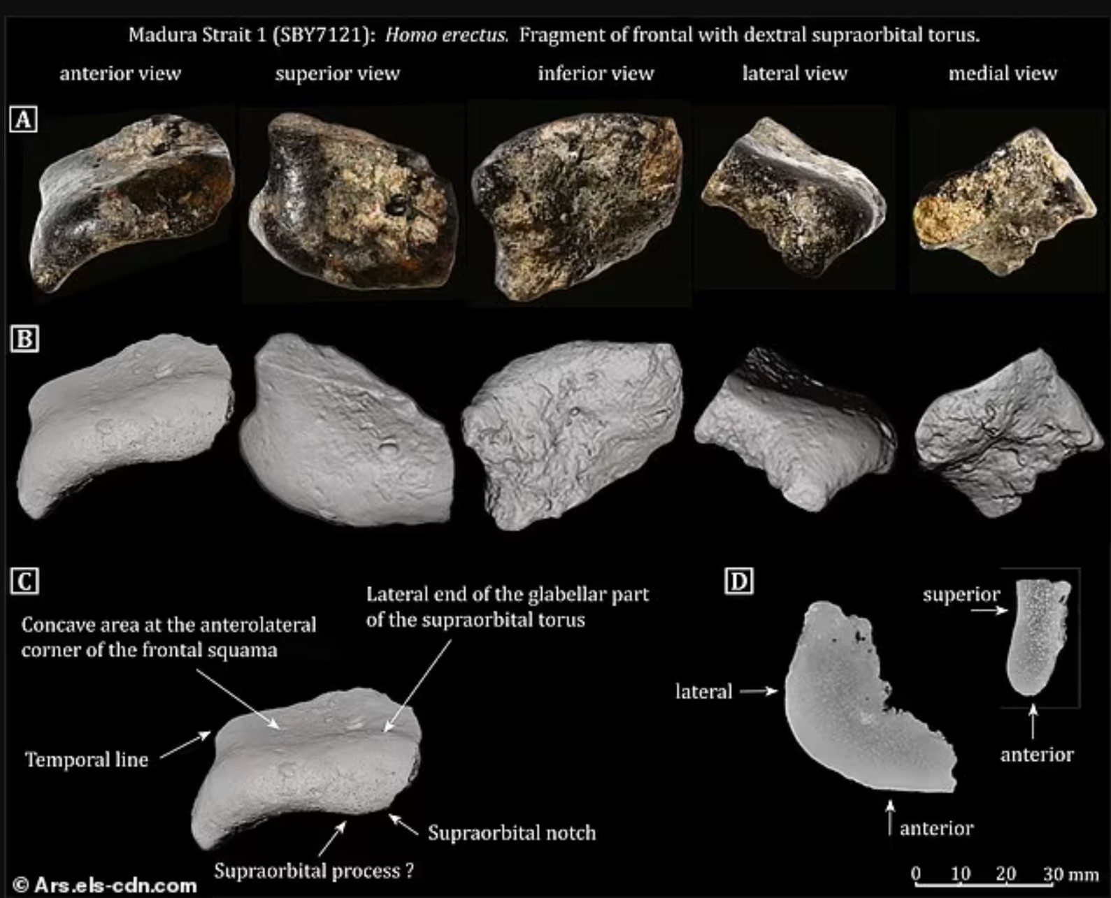 Enterrado bajo sedimentos durante 140 000 años, el cráneo ha sido identificado recientemente como perteneciente al Homo erectus, lo que redefine lo que sabemos sobre los inicios de la vida humana en el sudeste asiático.