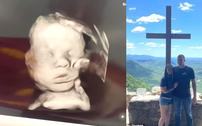 Mujer asegura que la “mano de Dios” apareció misteriosamente en una ecografía de su bebé luego de que rezara por su salud