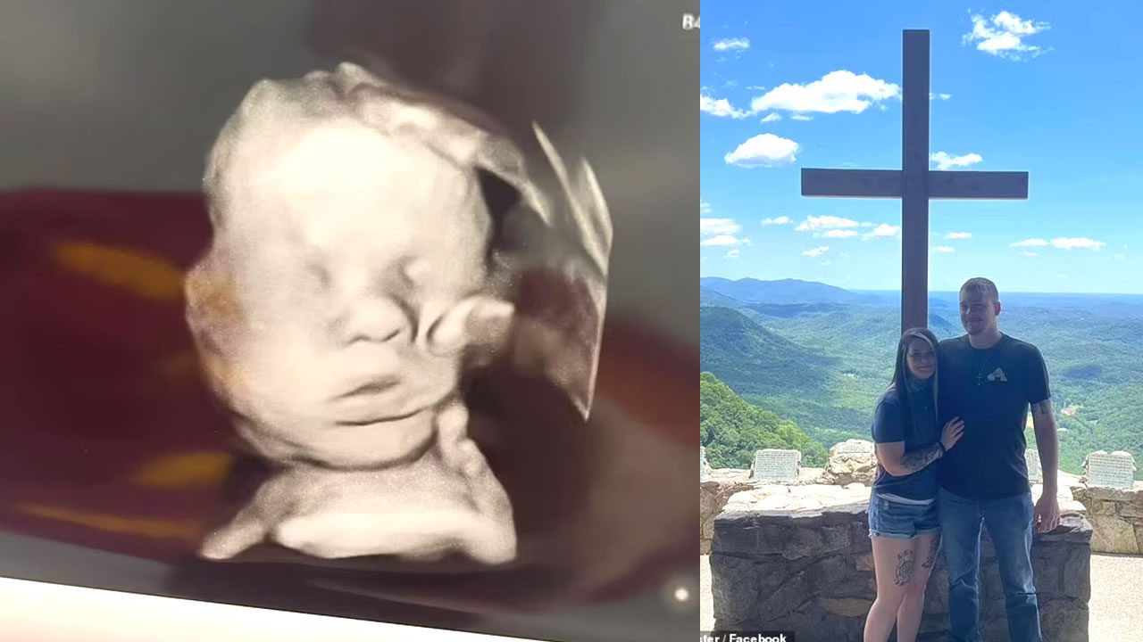 Mujer asegura que la "mano de Dios" apareció misteriosamente en una ecografía de su bebé luego de que rezara por su salud