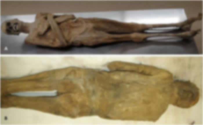 Apariencia externa de la momia desde el lado ventral (A) y dorsal (B), mostrando una pared corporal completamente intacta.