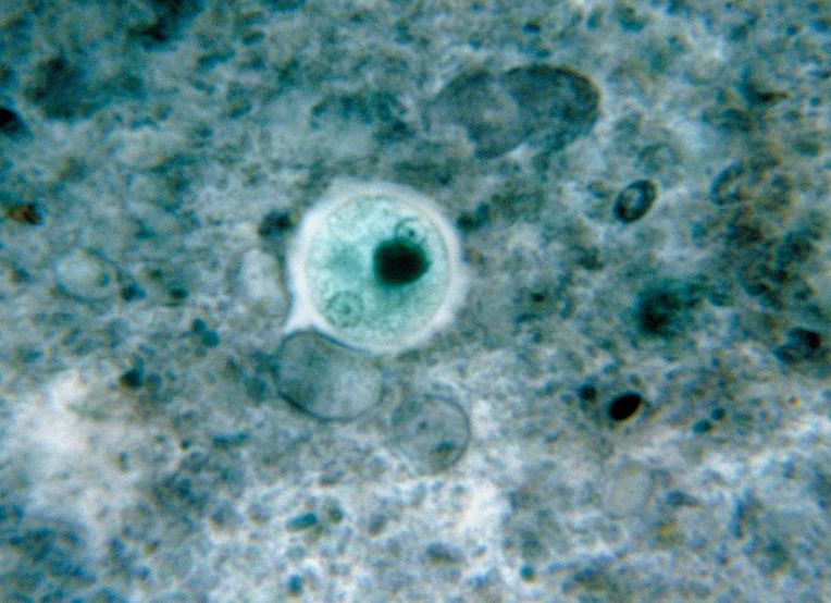 Esta micrografía teñida con clorazol negro reveló un quiste de Entamoeba histolytica. Varias especies de protozoos del género Entamoeba infectan a los seres humanos, pero no todas están asociadas a enfermedades. Entamoeba histolytica es una ameba patógena bien conocida, asociada a infecciones intestinales y extraintestinales.