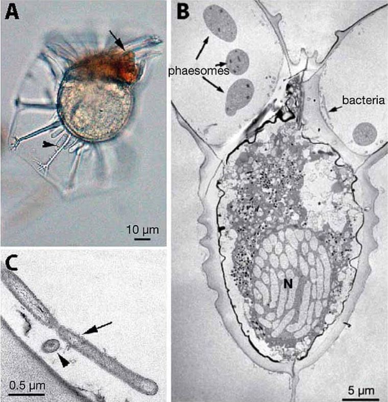 Según los investigadores, estos diminutos organismos se conocen oficialmente como "diazotróficos no cianobacterianos". Estos microorganismos, principalmente bacterias y arqueas, pueden convertir el nitrógeno atmosférico en una forma utilizable, pero no realizan la fotosíntesis como las cianobacterias.